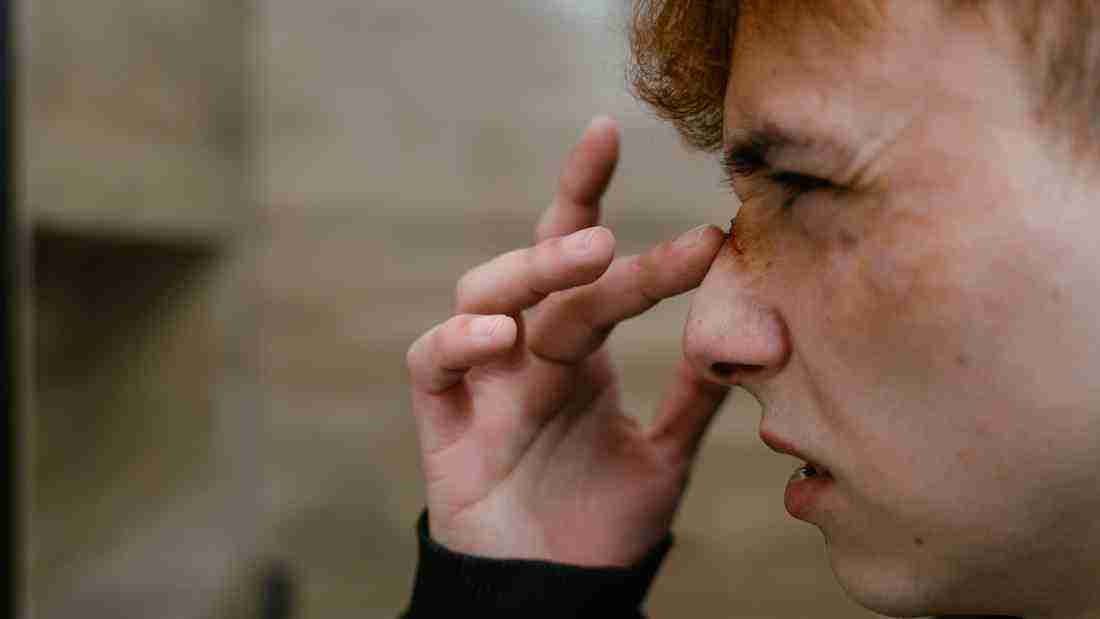 A young man with a wound on his face